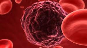 What You Need To Do To Detect 19 Types Of Cancer 7 Years Before Symptoms Strike Cancer