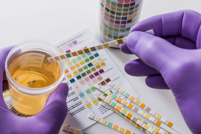 Varsity Lecturers Asked To Undergo Drug Test DRUG TEST