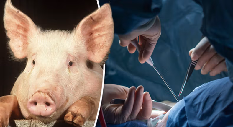 Man Dies Seven Weeks After Receiving Pig Kidney Transplant PIG