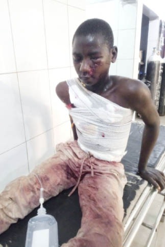 Police Arrest Survivor Of Abuja Explosion At Hospital WhatsApp Image 2025 02 03 at 10.54.31 AM