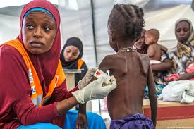 Presidency Calls for Multi-Stakeholder Approach to Combat Malnutrition in Nigeria malnutrition