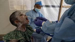 Health Matter: What You Need To Know About Mpox Viral Disease mpoxxx